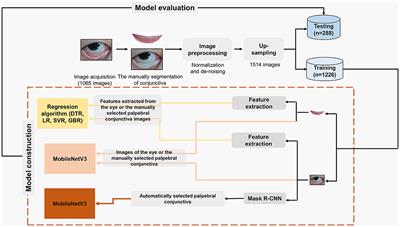 A new, feasible, and convenient method based on semantic segmentation and deep learning for hemoglobin monitoring